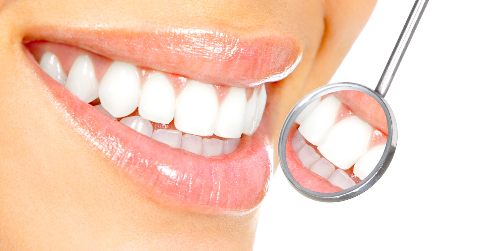 home – VISITA ODONTOIATRICA + PULIZIA DEI DENTI + LUCIDATURA A SOLI 20 EURO COSA ASPETTI! – Studio Dental Smile